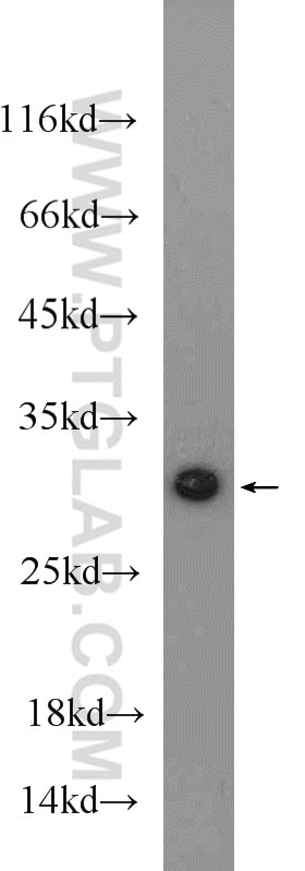 Western Blot (WB) analysis of mouse heart tissue using MTX2 Polyclonal antibody (11610-1-AP)