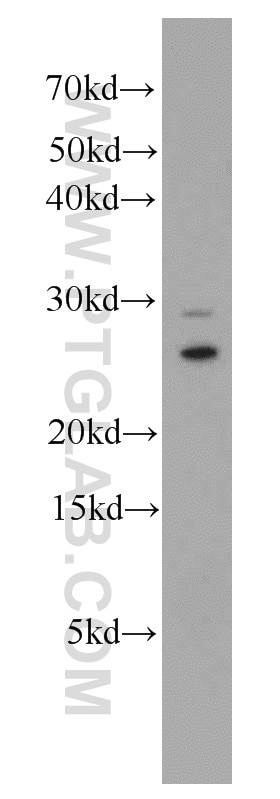 Western Blot (WB) analysis of mouse kidney tissue using MTX2 Polyclonal antibody (11610-1-AP)