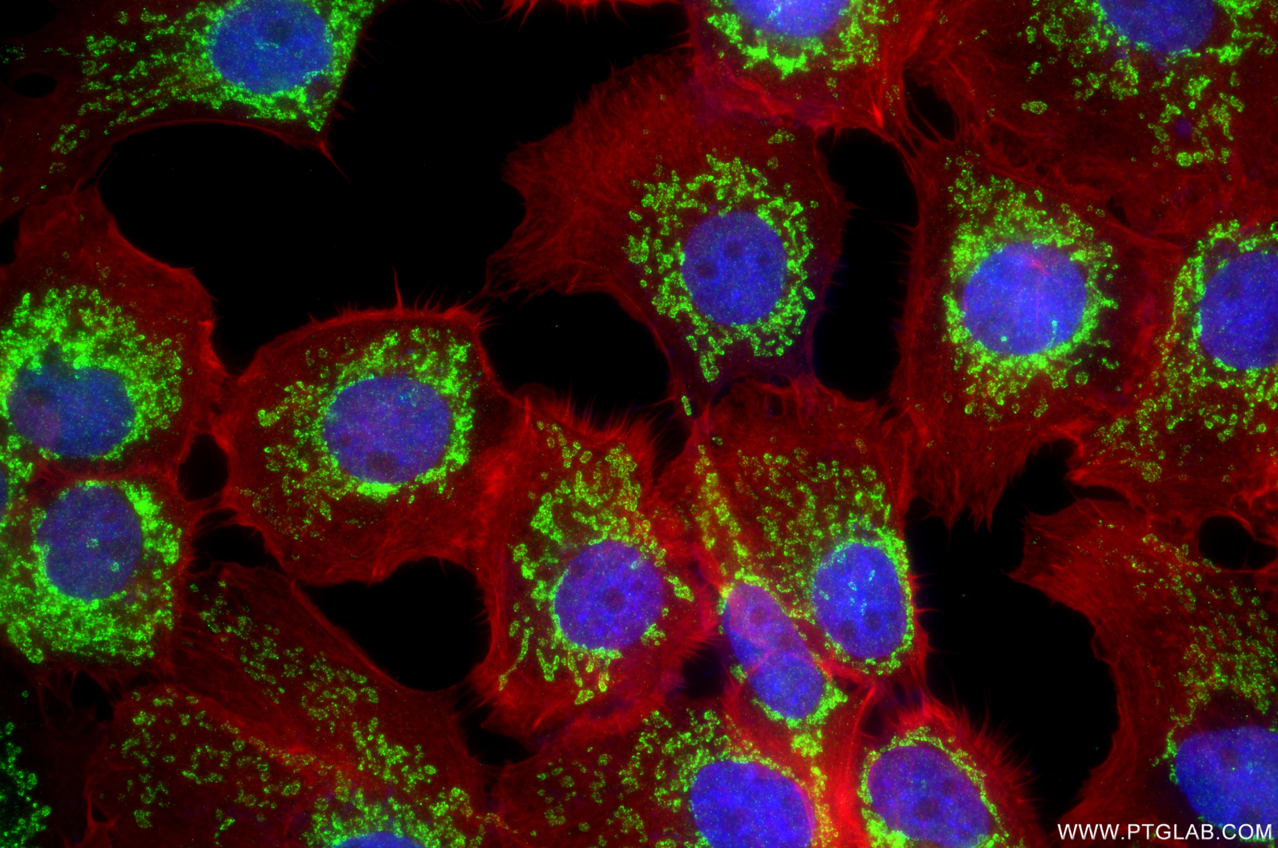 Immunofluorescence (IF) / fluorescent staining of A431 cells using MTX2 Recombinant monoclonal antibody (86899-1-RR)