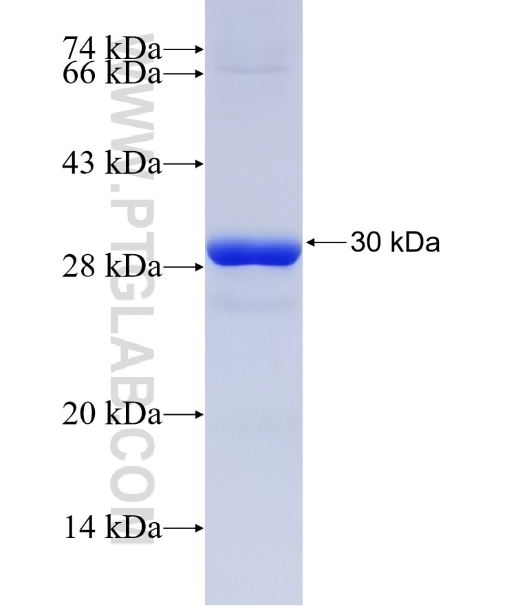 MTX2 fusion protein Ag22889 SDS-PAGE MTX2 fusion protein Ag22889 SDS-PAGE