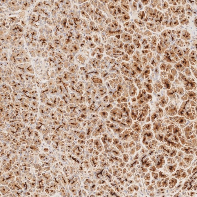 IHC staining of human pancreas using 83311-4-RR Immunohistochemistry (IHC) staining of human pancreas tissue using MUC1/CA15-3 C-terminal Recombinant monoclonal anti (83311-4-RR)