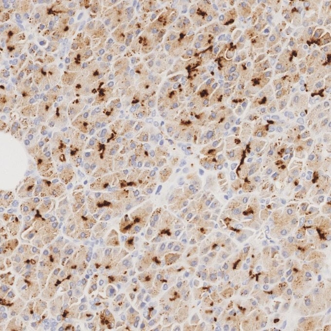 IHC staining of human pancreas using 83311-4-RR Immunohistochemistry (IHC) staining of human pancreas tissue using MUC1/CA15-3 C-terminal Recombinant monoclonal anti (83311-4-RR)