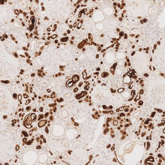 IHC staining of human kidney using 83311-4-RR Immunohistochemistry (IHC) staining of human kidney tissue using MUC1/CA15-3 C-terminal Recombinant monoclonal anti (83311-4-RR)