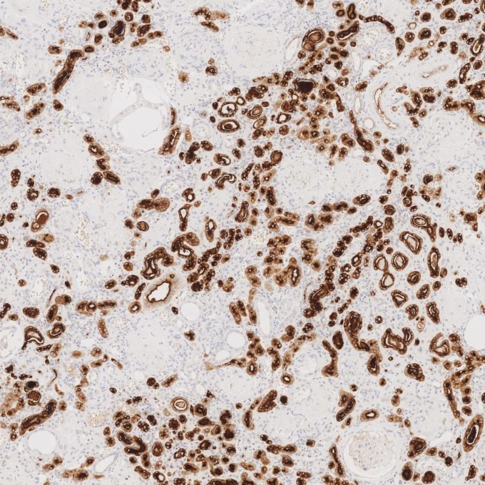 IHC staining of human kidney using 83311-4-RR Immunohistochemistry (IHC) staining of human kidney tissue using MUC1/CA15-3 C-terminal Recombinant monoclonal anti (83311-4-RR)