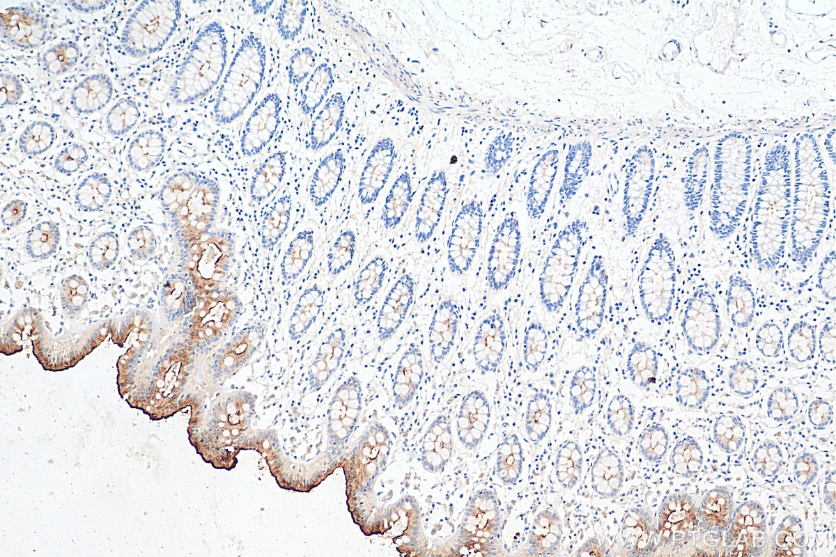 Immunohistochemistry (IHC) staining of human colon tissue using MUC13 Polyclonal antibody (29832-1-AP)