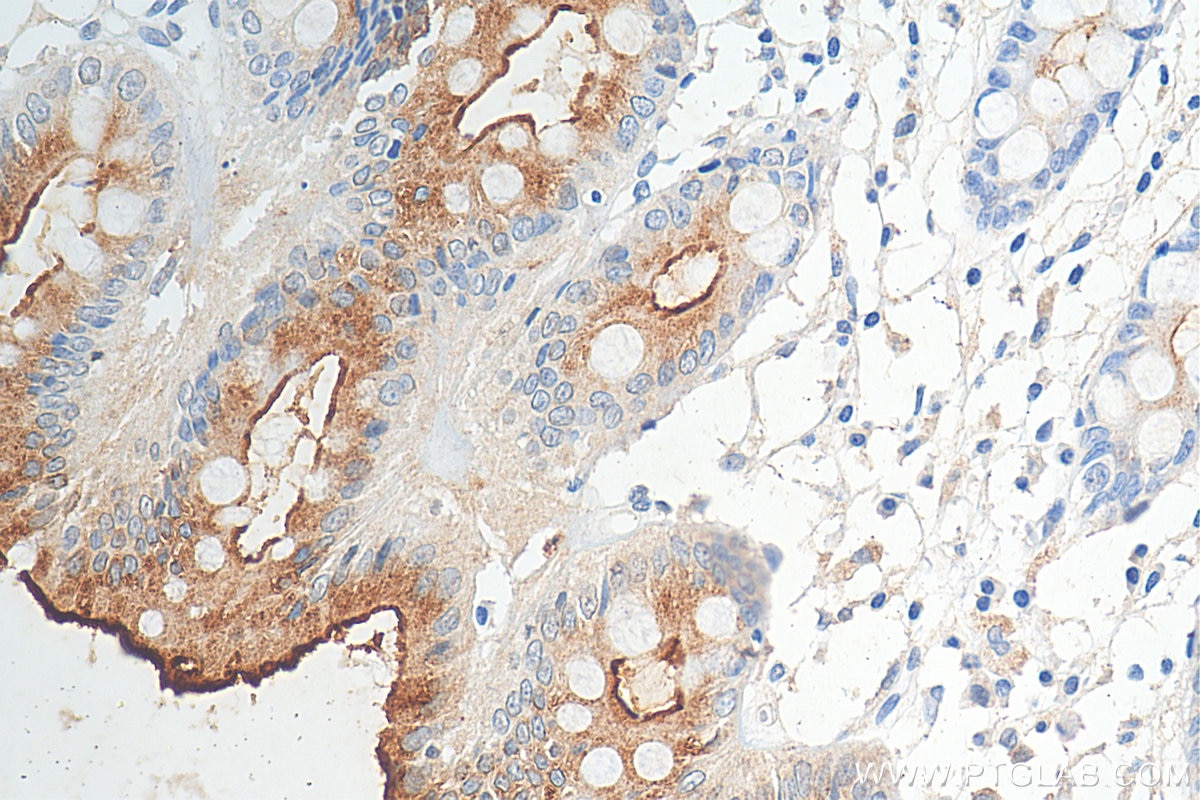 IHC staining of human colon using 29832-1-AP