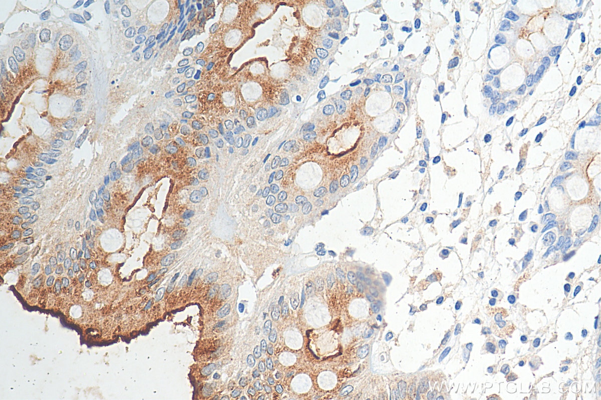 Immunohistochemistry (IHC) staining of human colon tissue using MUC13 Polyclonal antibody (29832-1-AP)