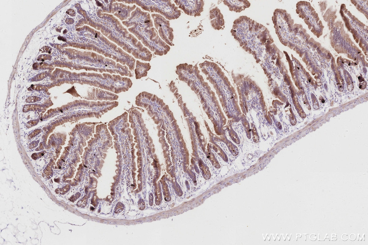 IHC staining of mouse small intestine using 55487-1-AP Immunohistochemistry (IHC) staining of mouse small intestine tissue using MUC13 Polyclonal antibody (55487-1-AP)