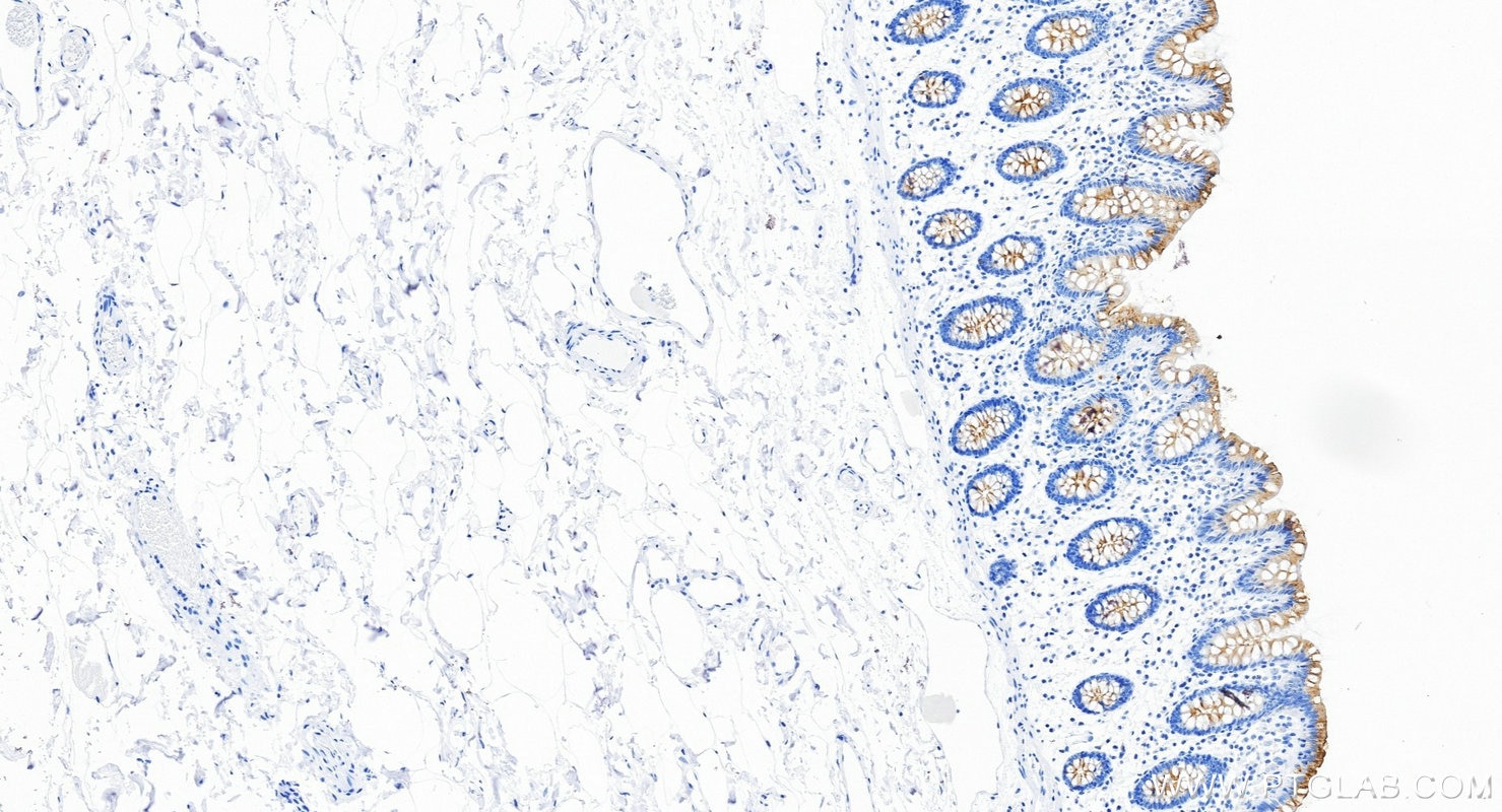 Immunohistochemistry (IHC) staining of human colon tissue using MUC13 Recombinant monoclonal antibody (87107-2-RR)