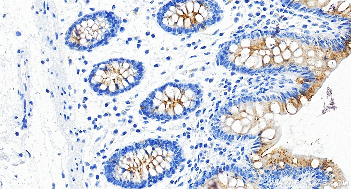 Immunohistochemistry (IHC) staining of human colon tissue using MUC13 Recombinant monoclonal antibody (87107-2-RR)