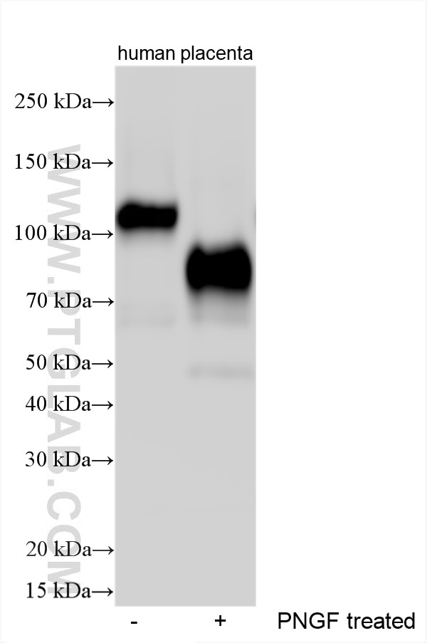 Western Blot (WB) analysis of various lysates using MUC15 Polyclonal antibody (33669-1-AP)