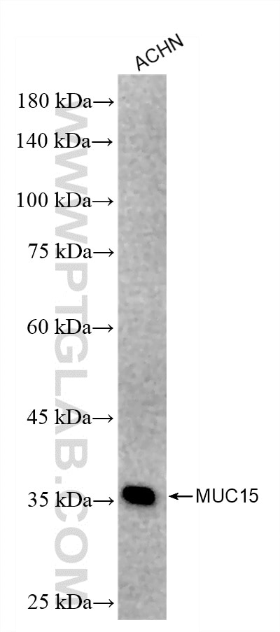 Western Blot (WB) analysis of ACHN cells using MUC15 Recombinant monoclonal antibody (86987-1-RR)
