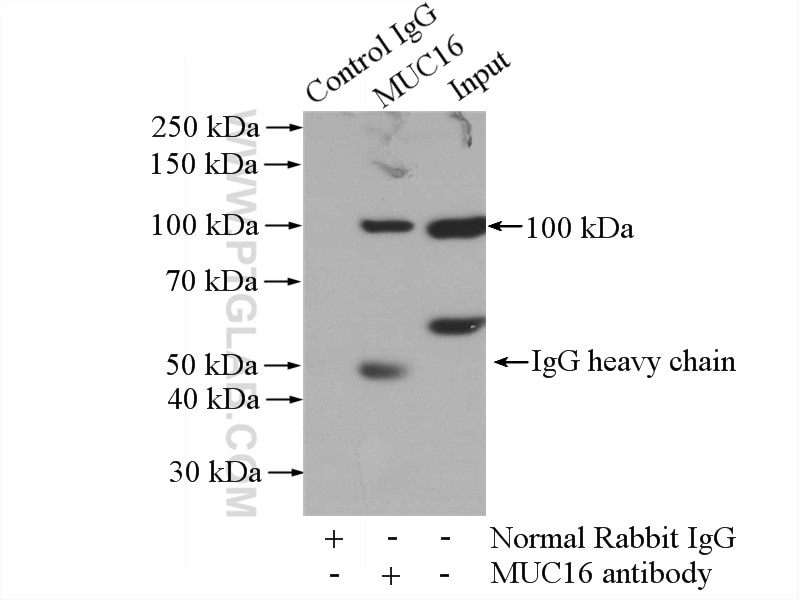 Immunoprecipitation (IP) experiment of HeLa cells using MUC16,CA125 Polyclonal antibody (20077-1-AP)