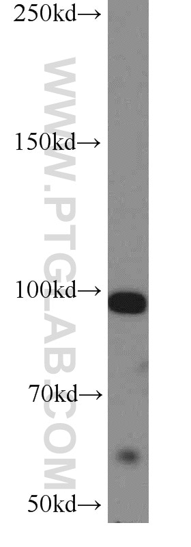 Western Blot (WB) analysis of HeLa cells using MUC16,CA125 Polyclonal antibody (20077-1-AP)