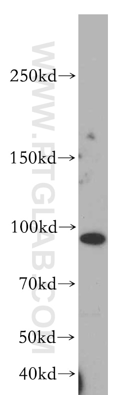 Western Blot (WB) analysis of HeLa cells using MUC16,CA125 Polyclonal antibody (20077-1-AP)