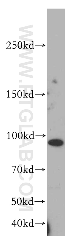 WB analysis of HeLa using 20077-1-AP