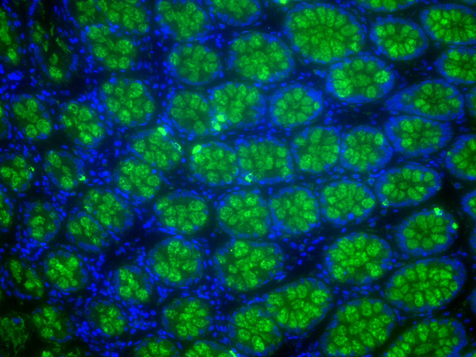 Immunofluorescence (IF) / fluorescent staining of human colon tissue using MUC2 Polyclonal antibody (27675-1-AP)