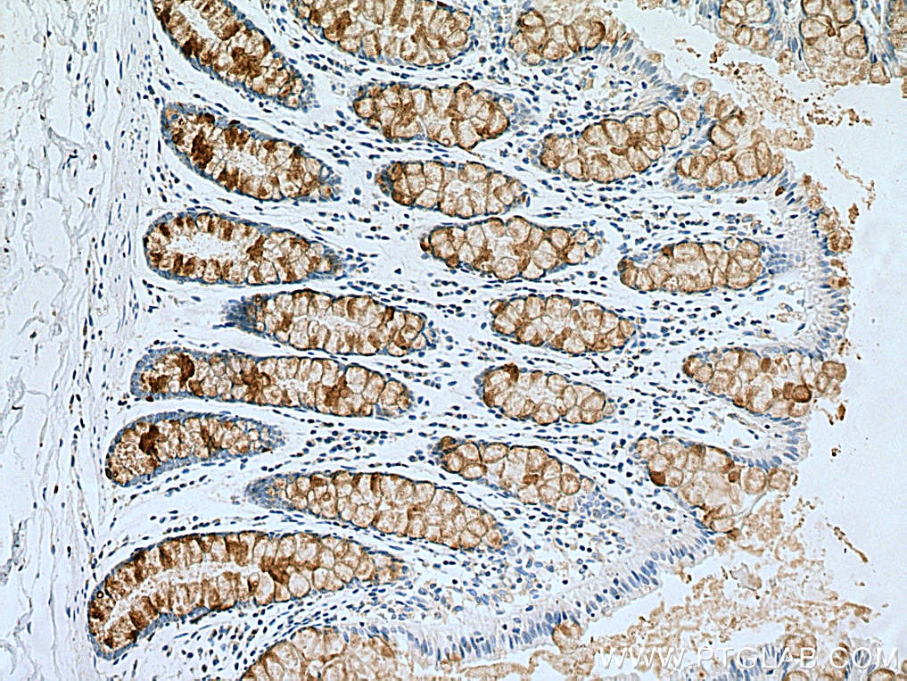 Immunohistochemistry (IHC) staining of human colon tissue using MUC2 Polyclonal antibody (27675-1-AP)