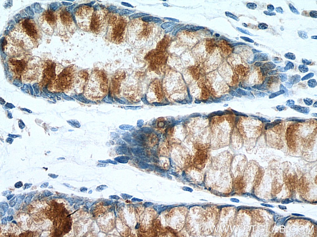 Immunohistochemistry (IHC) staining of human colon tissue using MUC2 Polyclonal antibody (27675-1-AP)