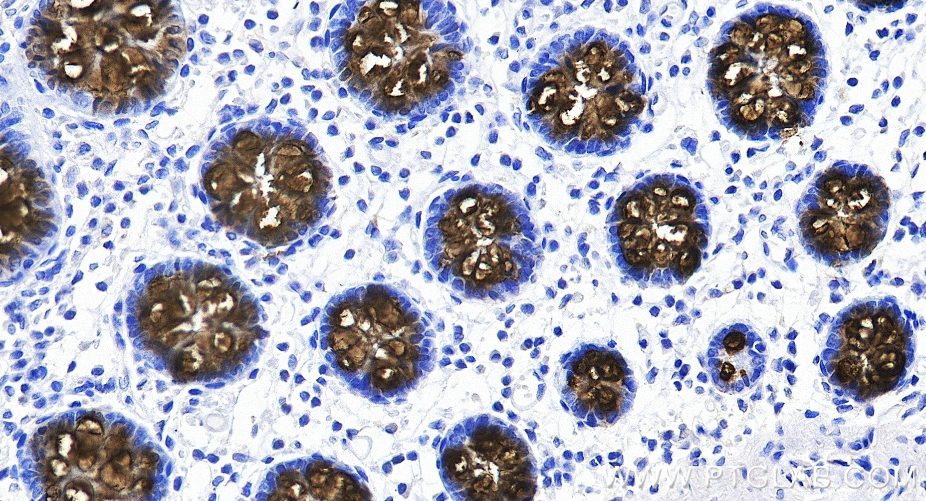 Immunohistochemistry (IHC) staining of human colon tissue using MUC2 Recombinant monoclonal antibody (82792-2-RR)