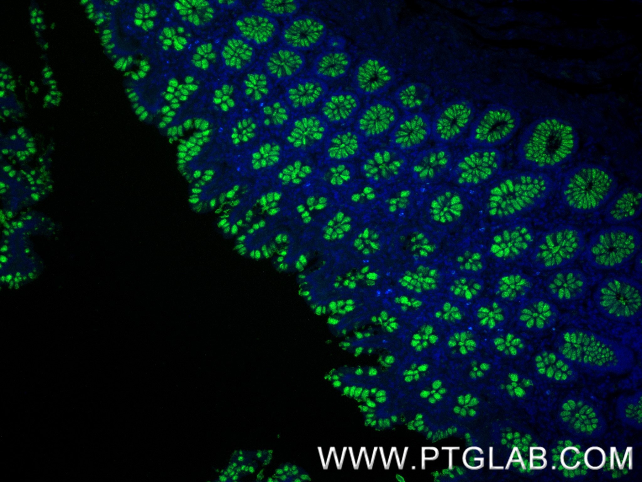 Immunofluorescence (IF) / fluorescent staining of human colon tissue using MUC2 Recombinant monoclonal antibody (82792-2-RR)