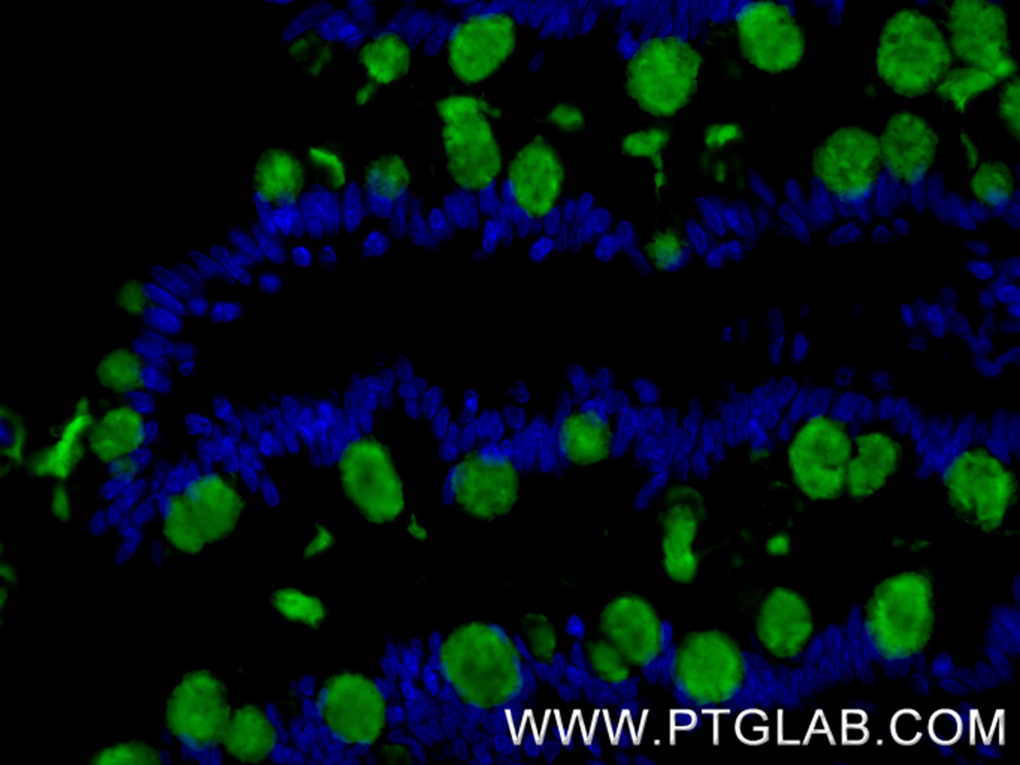 IF Staining of human small intestine using 82792-2-RR Immunofluorescence (IF) / fluorescent staining of human small intestine tissue using MUC2 Recombinant monoclonal antibody (82792-2-RR)