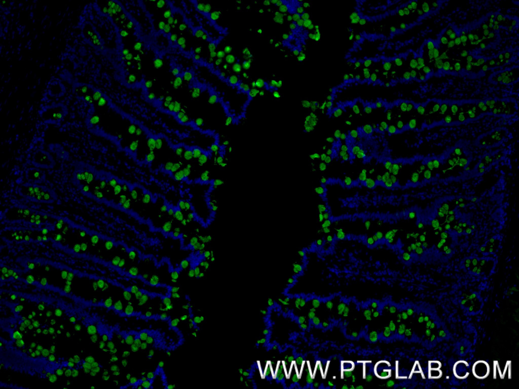 IF Staining of human small intestine using 82792-2-RR Immunofluorescence (IF) / fluorescent staining of human small intestine tissue using MUC2 Recombinant monoclonal antibody (82792-2-RR)
