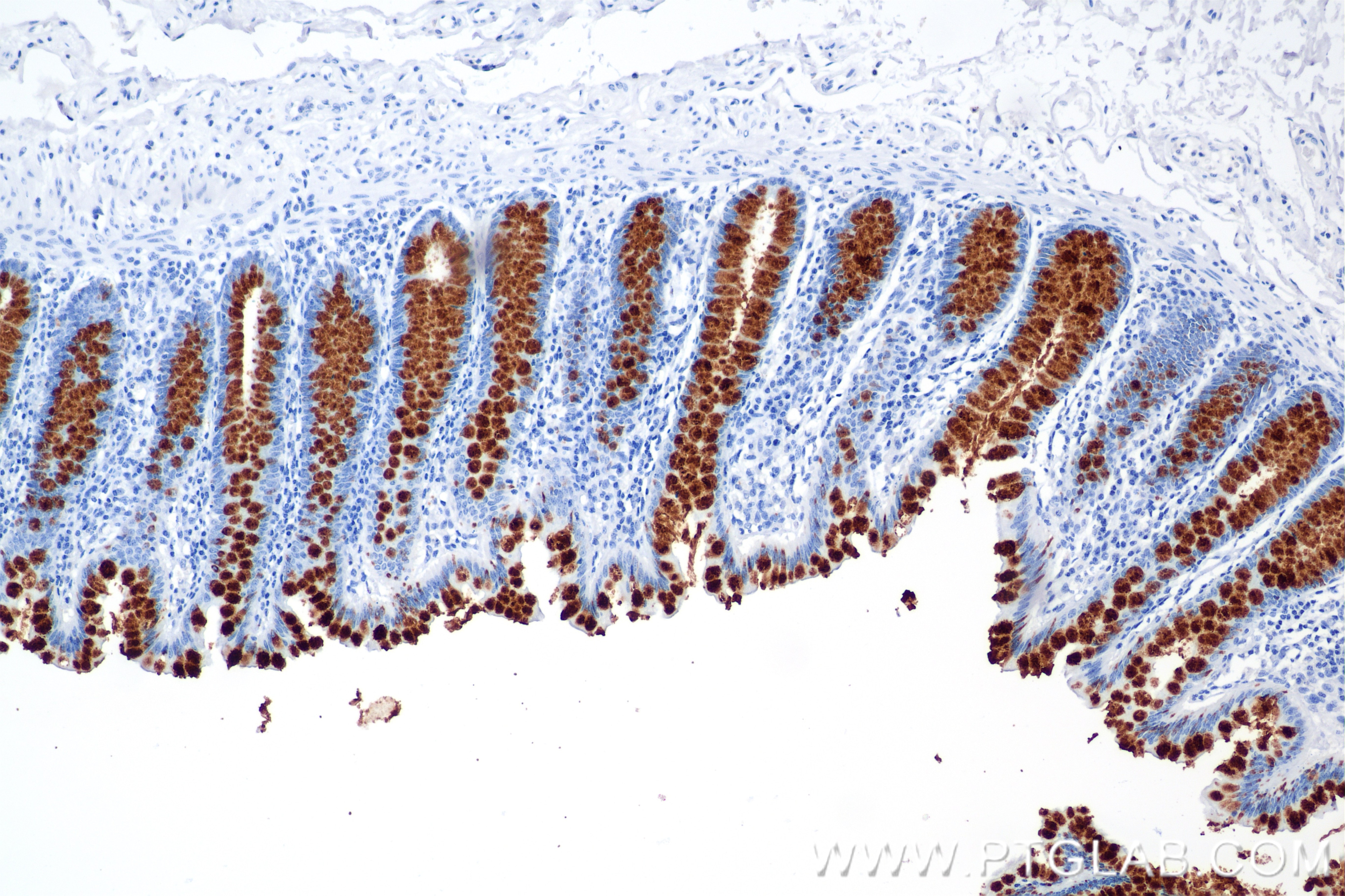 Immunohistochemistry (IHC) staining of human colon tissue using MUC2 Recombinant monoclonal antibody (82792-2-RR)