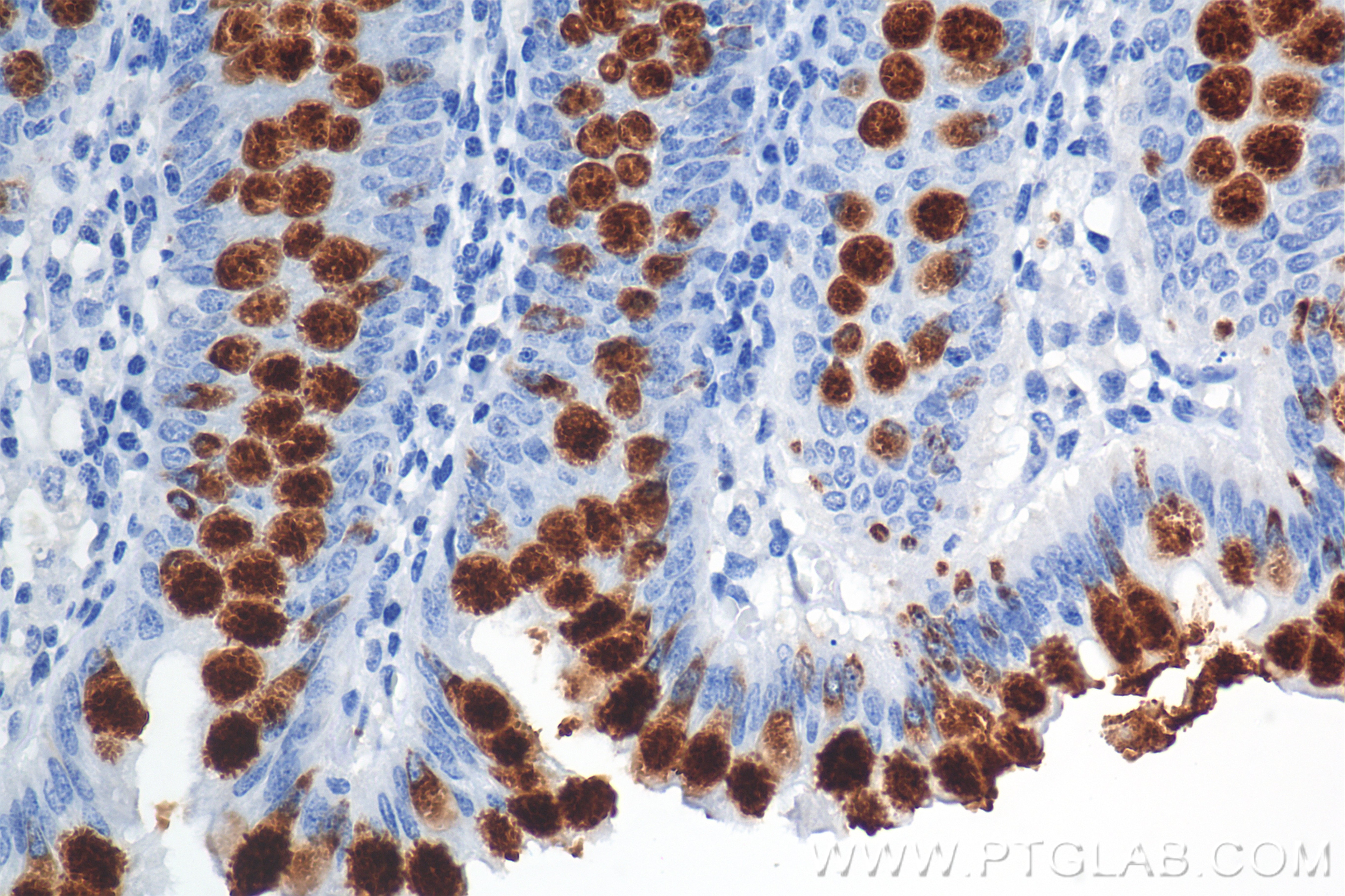 Immunohistochemistry (IHC) staining of human colon tissue using MUC2 Recombinant monoclonal antibody (82792-2-RR)