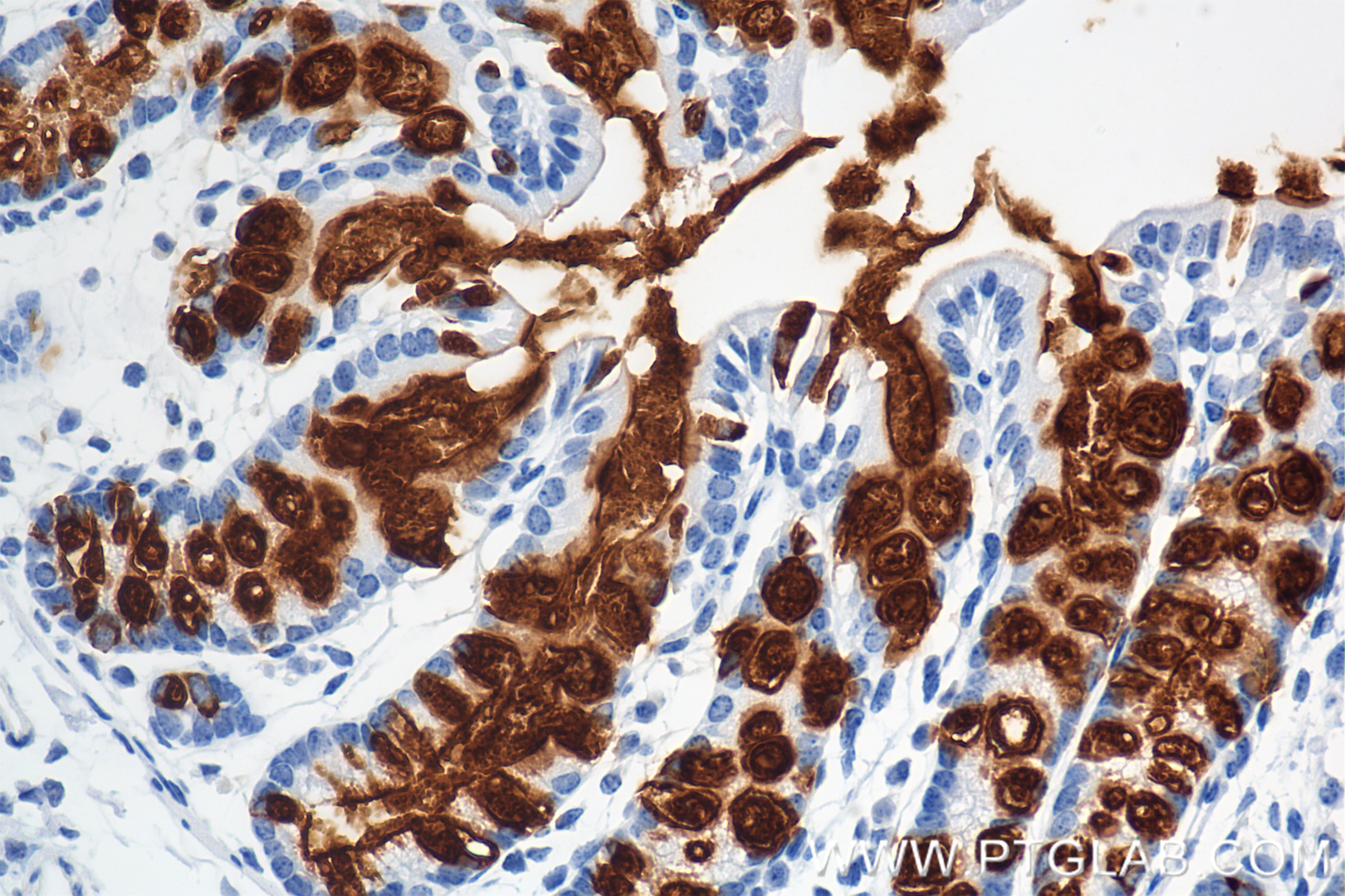Immunohistochemistry (IHC) staining of mouse colon tissue using MUC2 Recombinant monoclonal antibody (82792-2-RR)