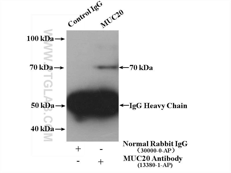 Immunoprecipitation (IP) experiment of mouse liver tissue using MUC20 Polyclonal antibody (13380-1-AP)