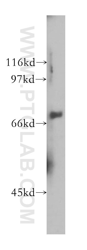 Western Blot (WB) analysis of human kidney tissue using MUC20 Polyclonal antibody (13380-1-AP)