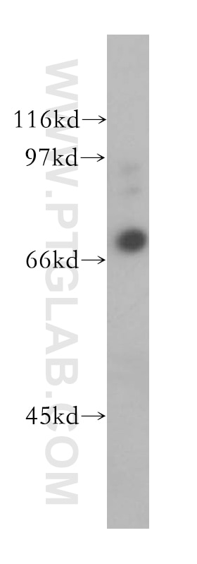 Western Blot (WB) analysis of human liver tissue using MUC20 Polyclonal antibody (13380-1-AP)