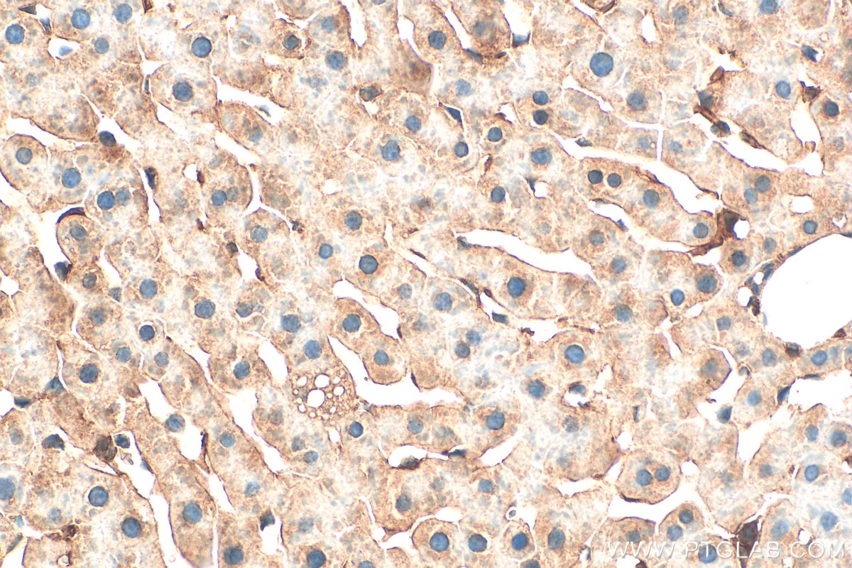Immunohistochemistry (IHC) staining of rat liver tissue using MUC20 Polyclonal antibody (30457-1-AP)