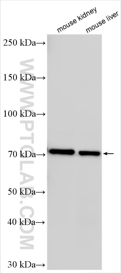 Western Blot (WB) analysis of various lysates using MUC20 Polyclonal antibody (30457-1-AP)