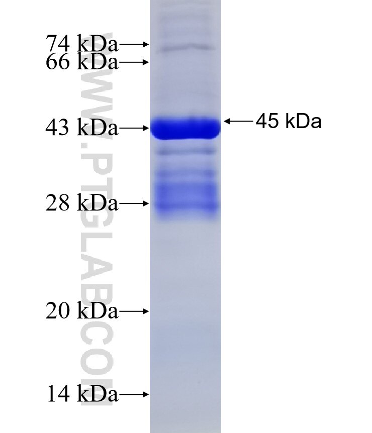 MUC20 fusion protein Ag31867 SDS-PAGE