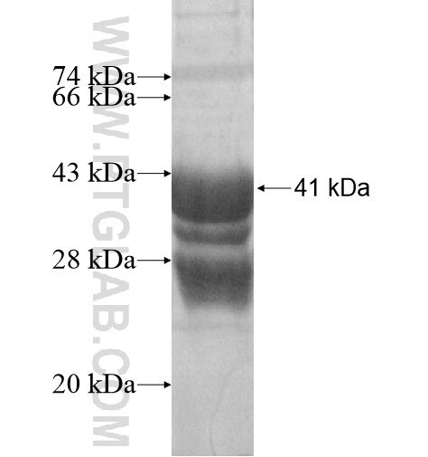 MUC21 fusion protein Ag15657 SDS-PAGE