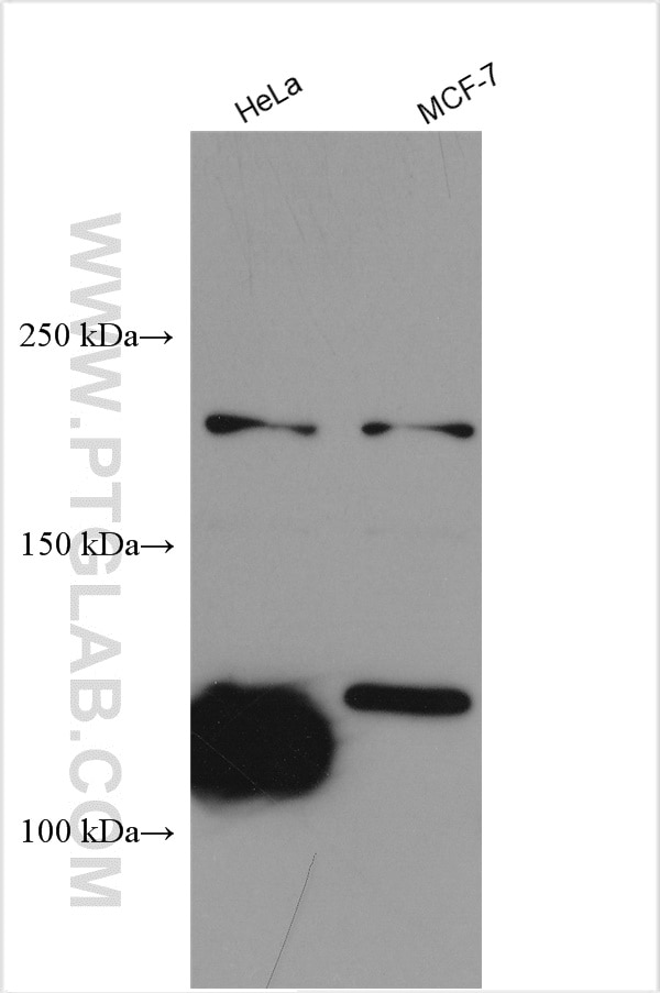 Western Blot (WB) analysis of various lysates using MUC4 Polyclonal antibody (28703-1-AP)