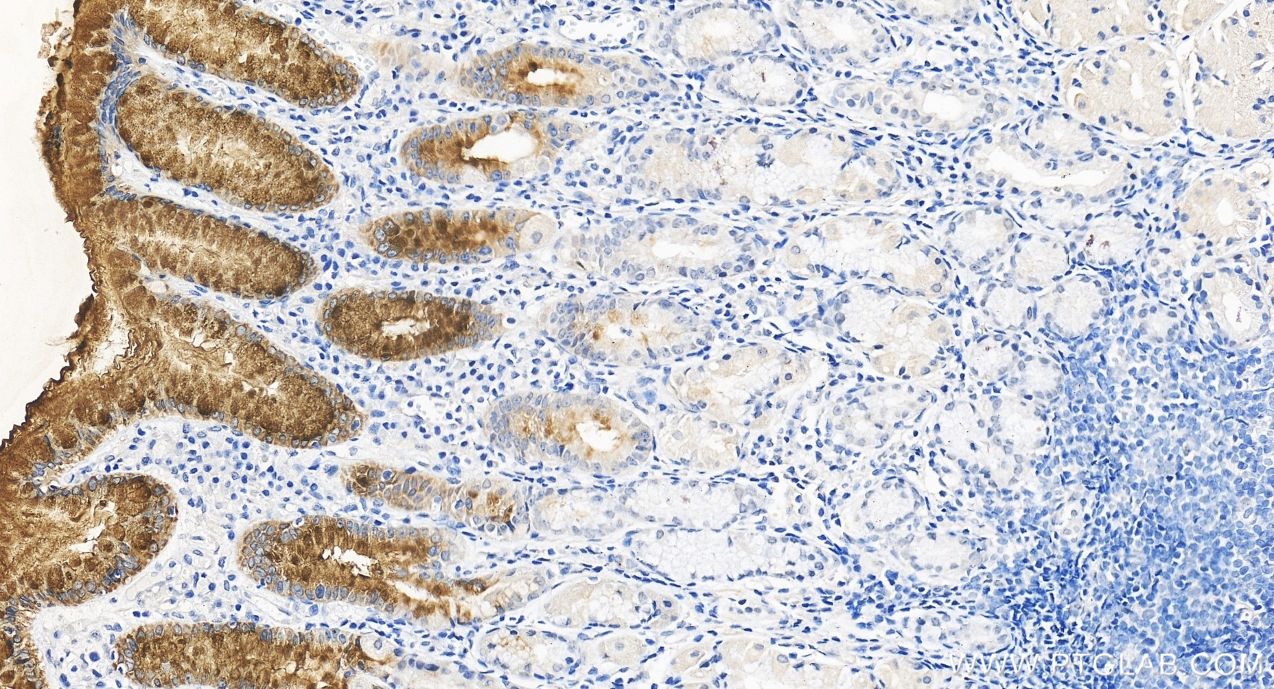 Immunohistochemistry (IHC) staining of human stomach tissue using MUC5AC Recombinant monoclonal antibody (85868-1-RR)