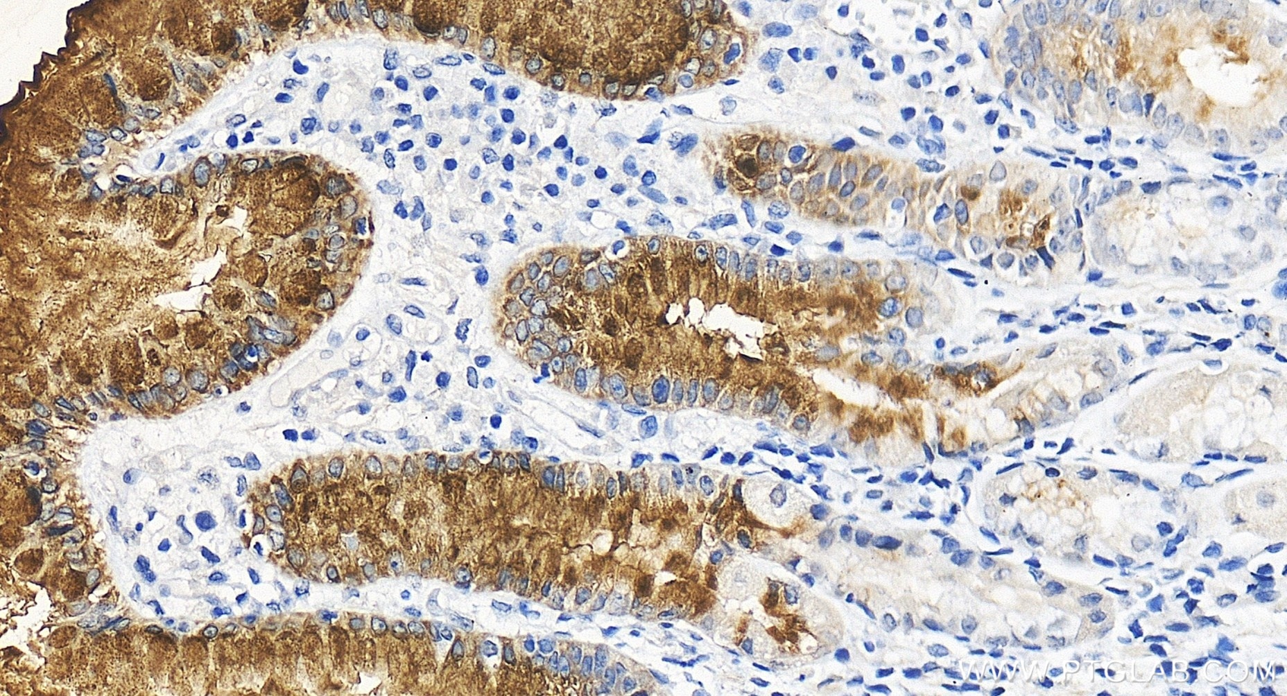 Immunohistochemistry (IHC) staining of human stomach tissue using MUC5AC Recombinant monoclonal antibody (85868-1-RR)