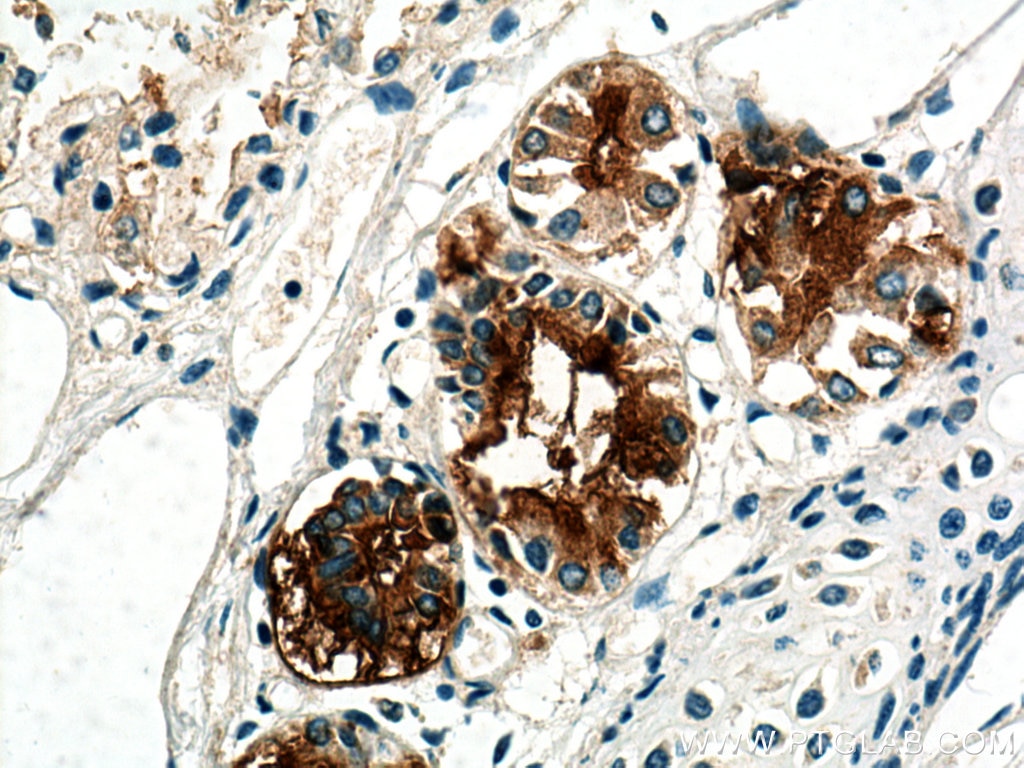 IHC staining of human lung using 28118-1-AP