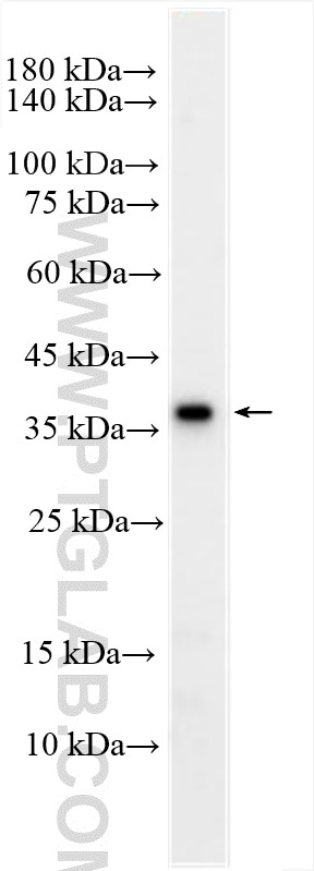 WB analysis of human saliva using 26544-1-AP