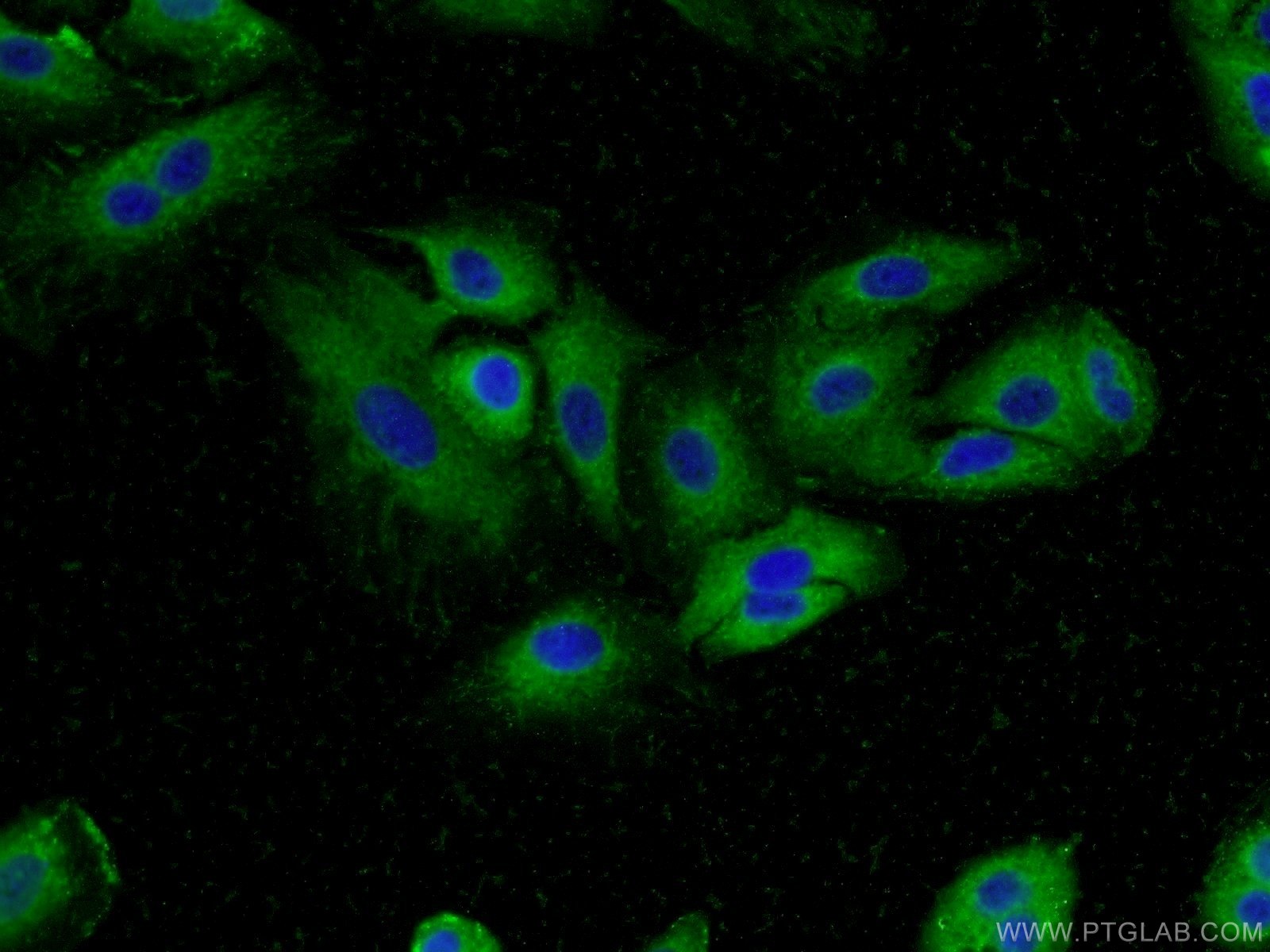 Immunofluorescence (IF) / fluorescent staining of A549 cells using MUC8 Polyclonal antibody (55489-1-AP)