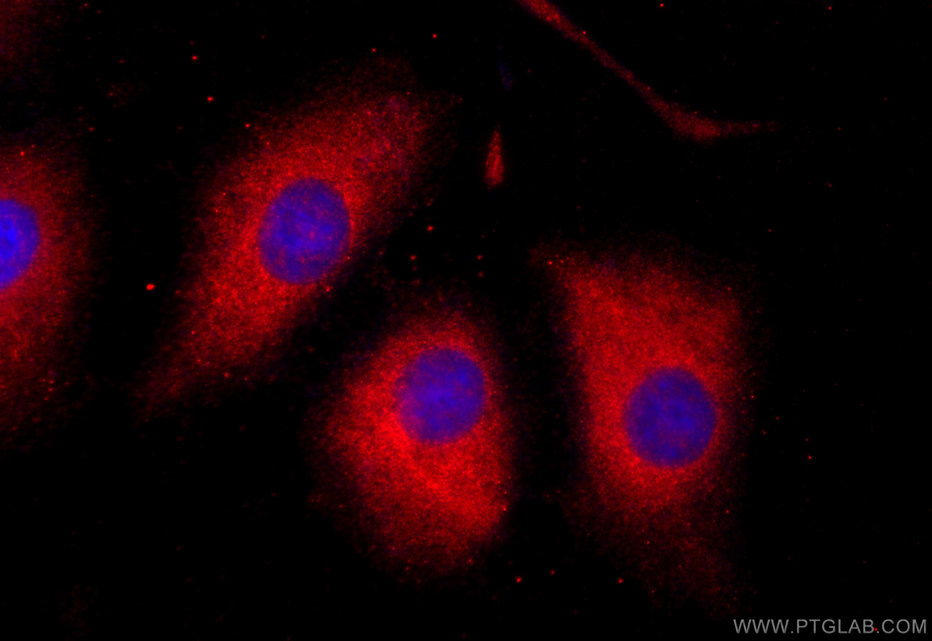 Immunofluorescence (IF) / fluorescent staining of A549 cells using MUC8 Polyclonal antibody (55489-1-AP)