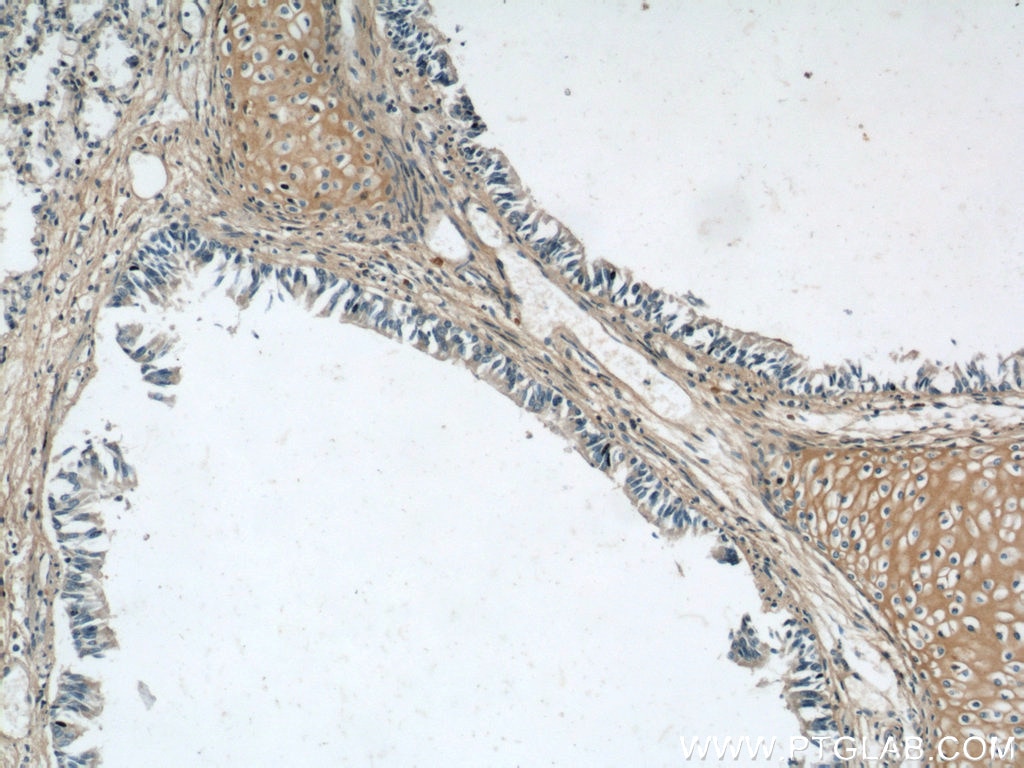 Immunohistochemistry (IHC) staining of human lung tissue using MUC8 Polyclonal antibody (55489-1-AP)