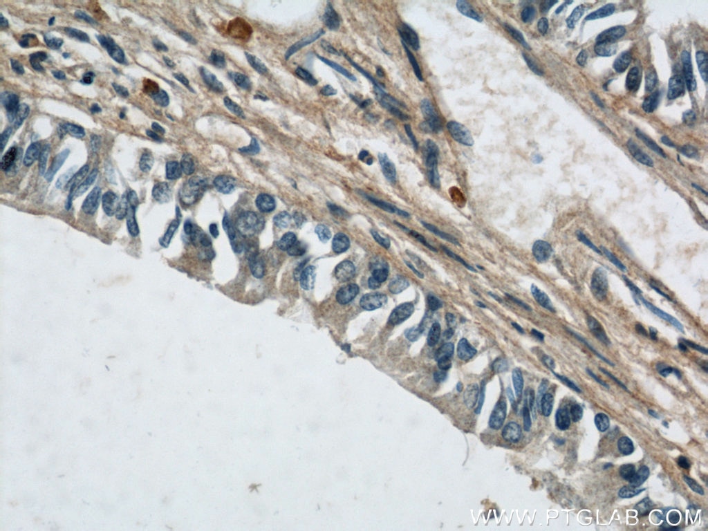 Immunohistochemistry (IHC) staining of human lung tissue using MUC8 Polyclonal antibody (55489-1-AP)