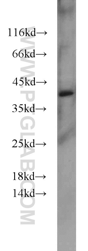 WB analysis of HeLa using 55489-1-AP