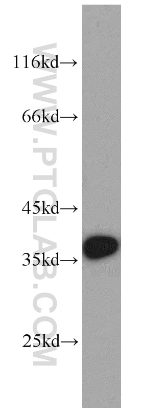 Western Blot (WB) analysis of A549 cells using MUC8 Polyclonal antibody (55489-1-AP)