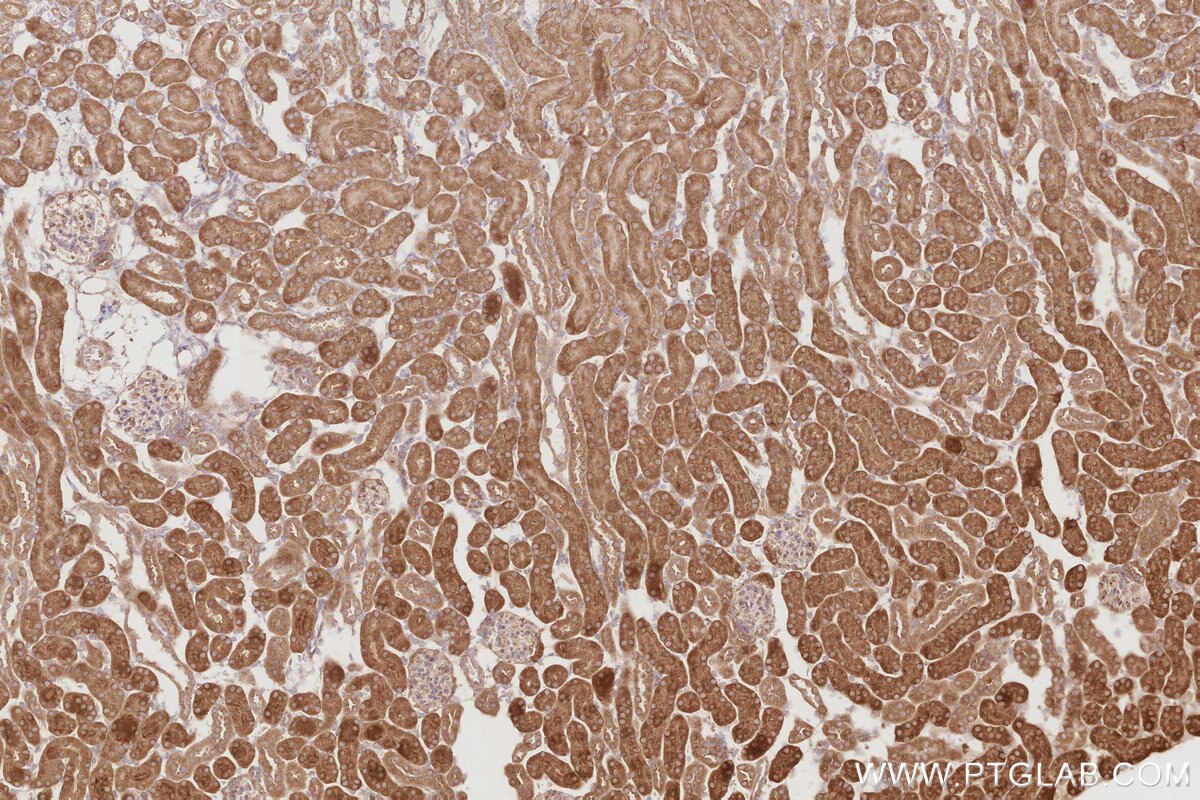 Immunohistochemistry (IHC) staining of mouse kidney tissue using MUDENG Polyclonal antibody (26567-1-AP)