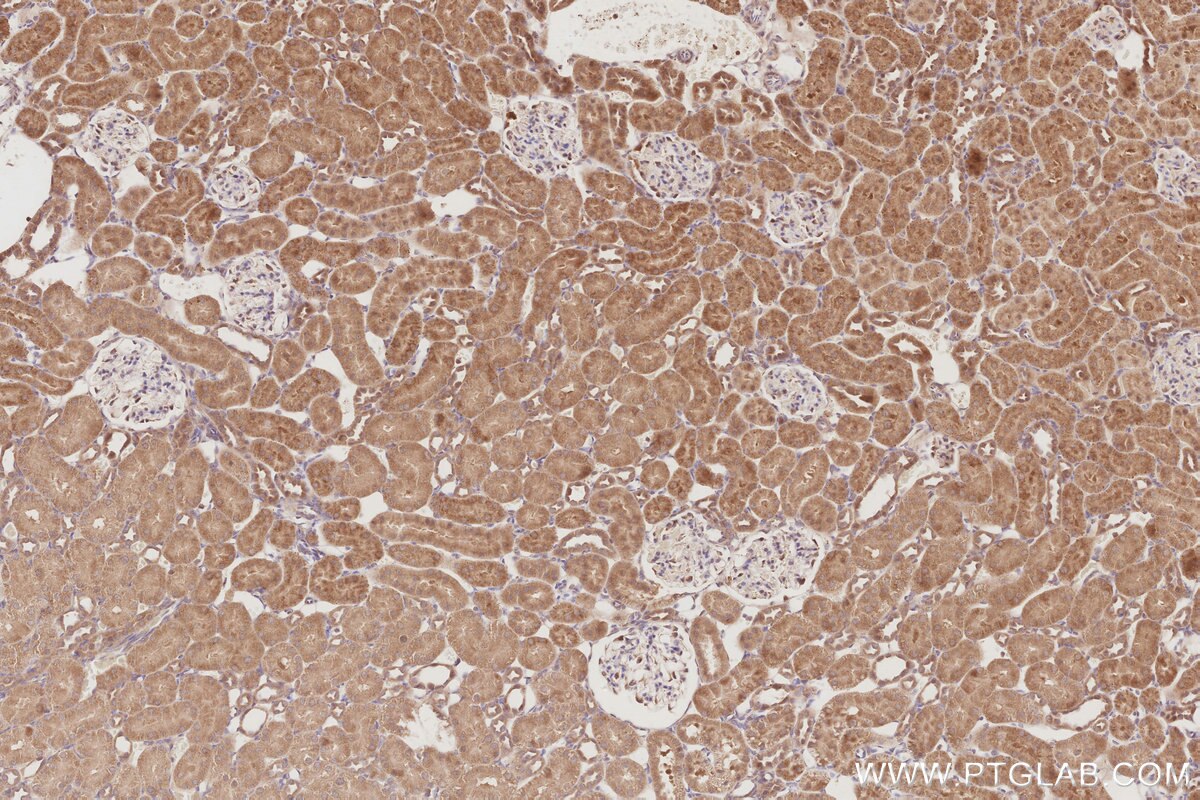 Immunohistochemistry (IHC) staining of rat kidney tissue using MUDENG Polyclonal antibody (26567-1-AP)